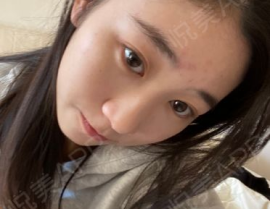 私密微整做紧,重塑自信之美